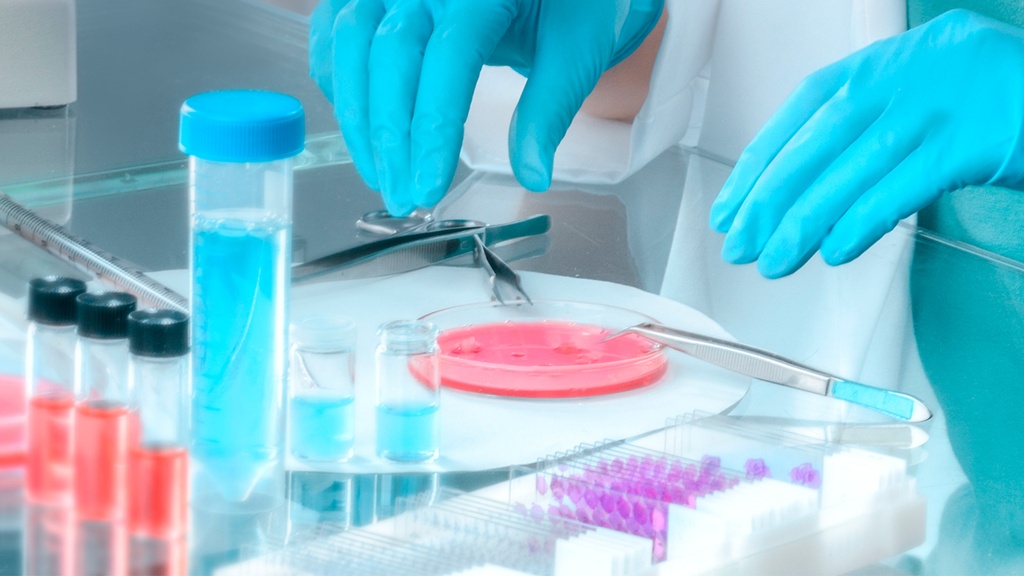 Cultivo de Ureaplasma Lapi Laboratorio Médico